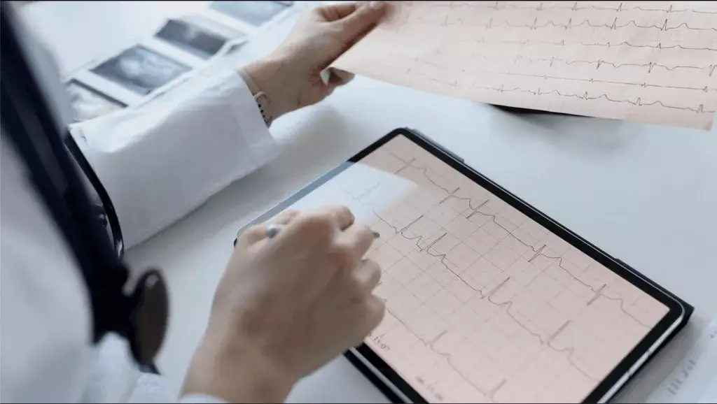 Infermeria i la interpretació de l'ECG