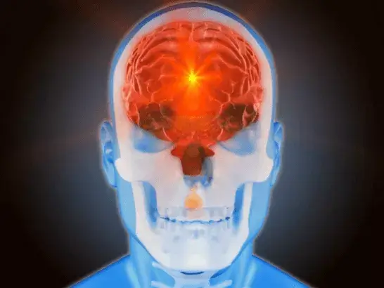 ictus-imatge.png